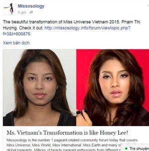 Miss Universe Vietnam suspected of undergoing plastic surgery